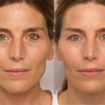 Eye Serum face 1200x