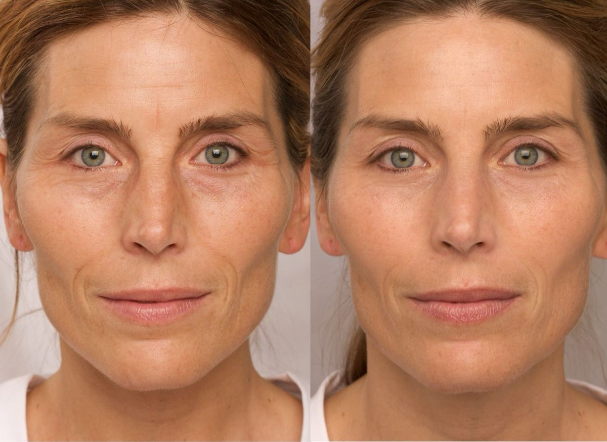 Eye Serum face 1200x