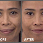 MAMA J before after peptide Serum page 0001 53d31cb2 0fcd 4f0c a96c b827198baa40 1200x