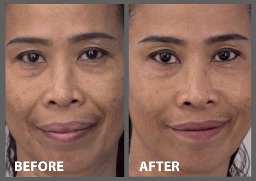 MAMA J before after peptide Serum page 0001 53d31cb2 0fcd 4f0c a96c b827198baa40 1200x