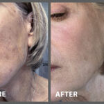 Shelly before after Peptide Serum scaled b5b45d83 dc1f 491f 9051 9039ce342e72 1200x