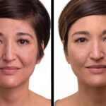 Before after1 1200x