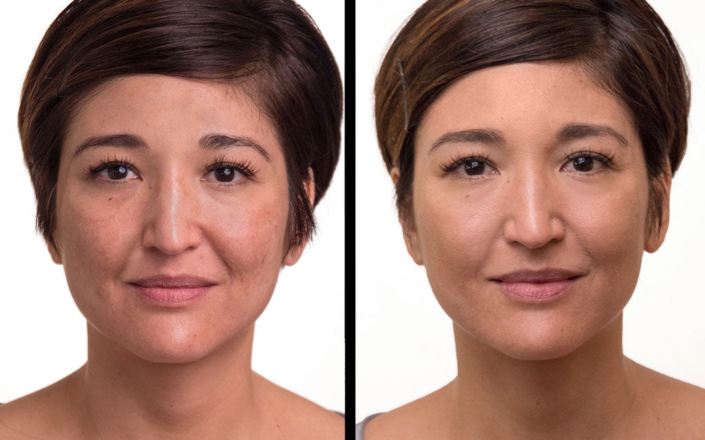 Before after1 1200x