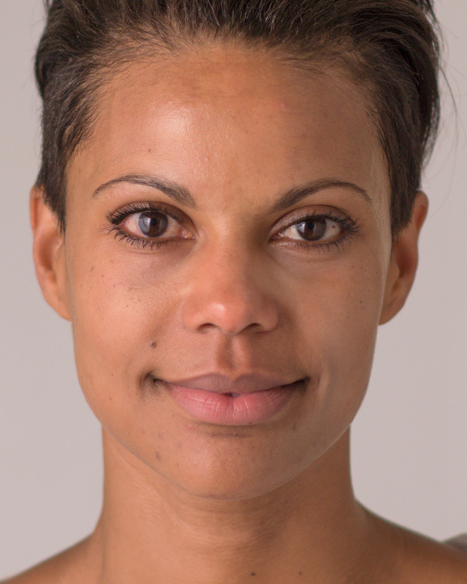 Victoria after